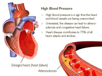 Can Effexor Cause High Blood Pressure